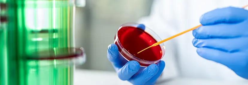 Petri dishes for the laboratory | SARSTEDT