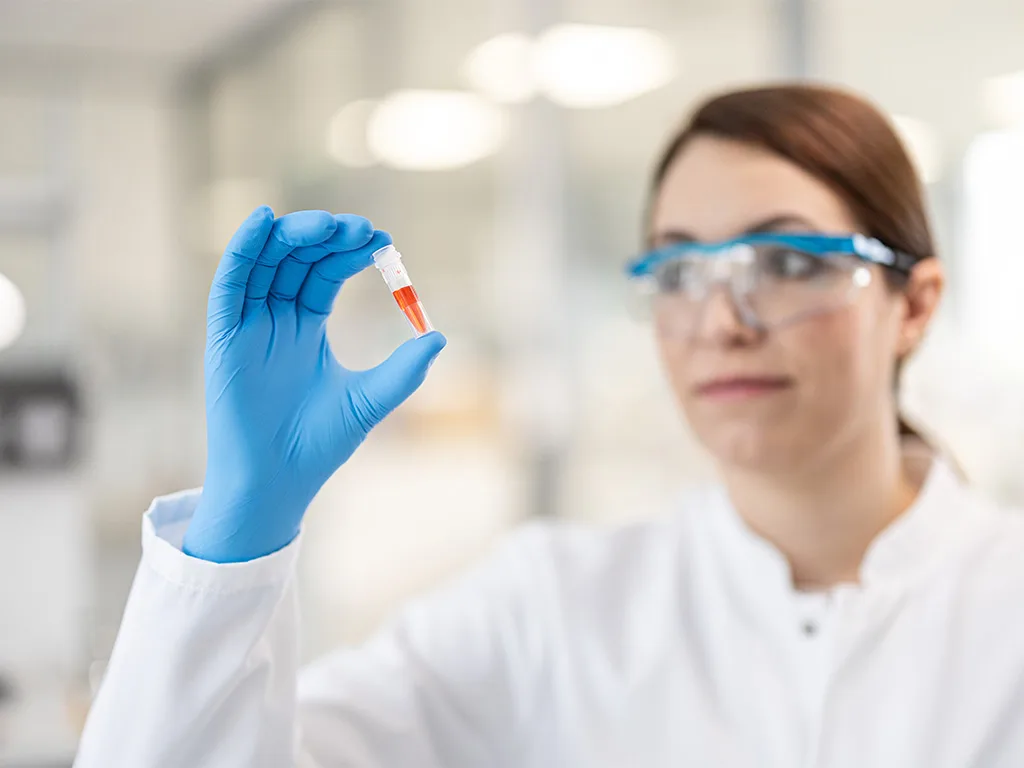 USE LS Probenhandling Probenhandling SARSTEDT RS314208 1024x768