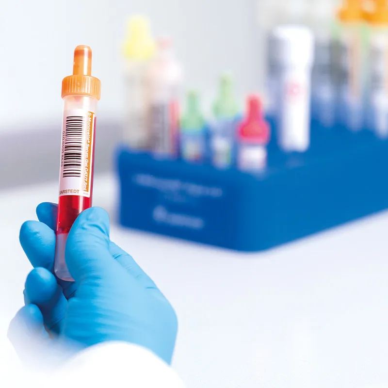 Digital - vorbarcodierte Probenröhre