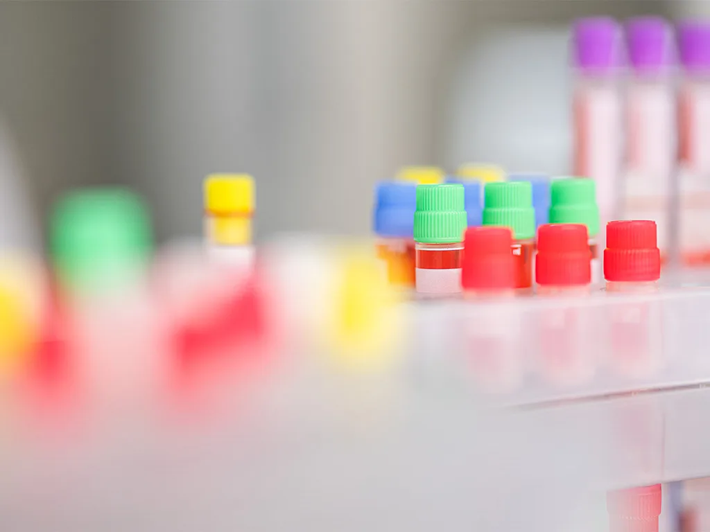 USE LS Mikrobiologie RS314073 1024x768