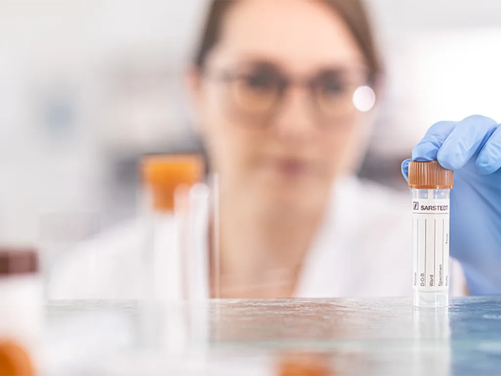 USE PA Stuhl Probengewinnung RS314589 1024x768