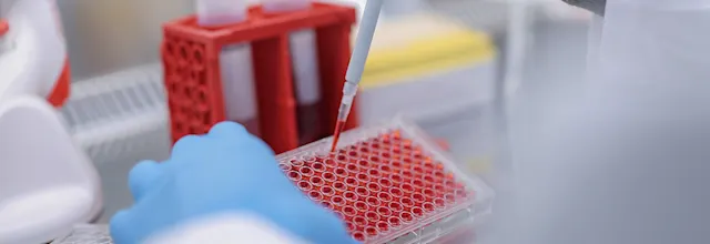 3D cell culture in the laboratory | SARSTEDT