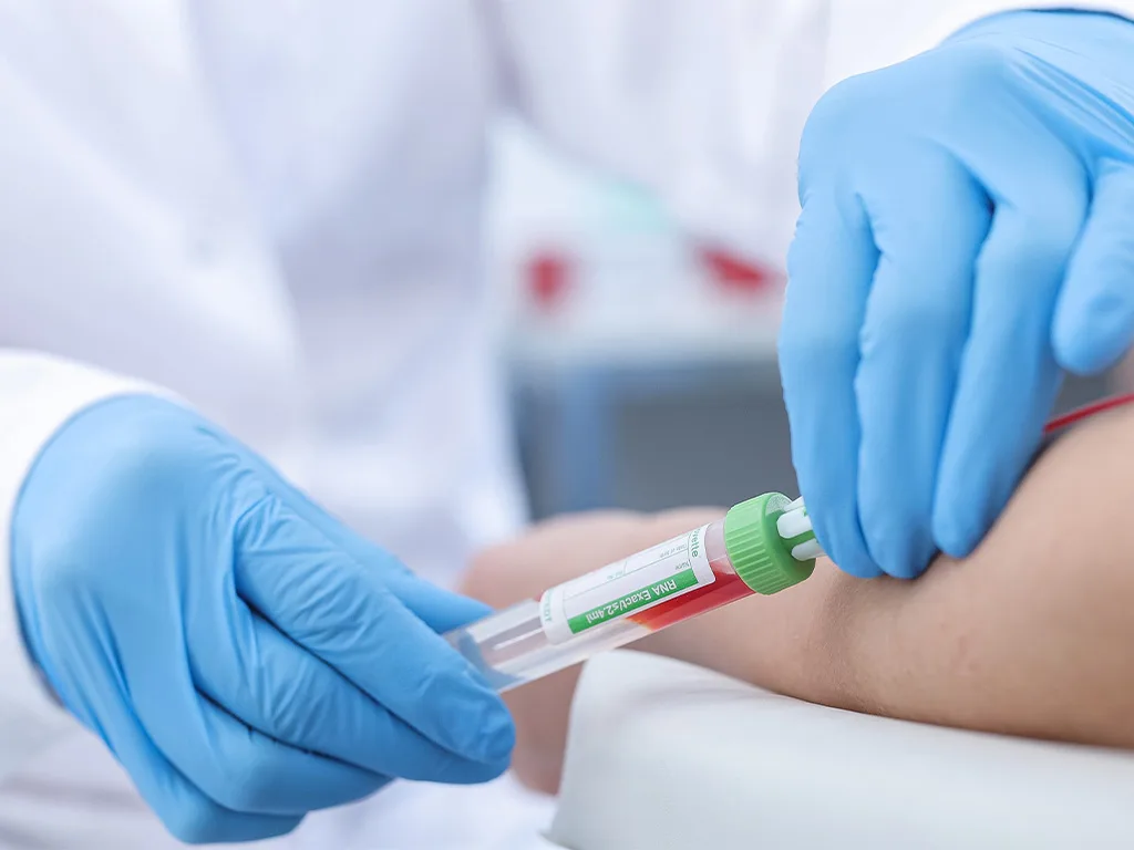 USE Probengewinnung Ven Blutentnahme RS297643 1024x768