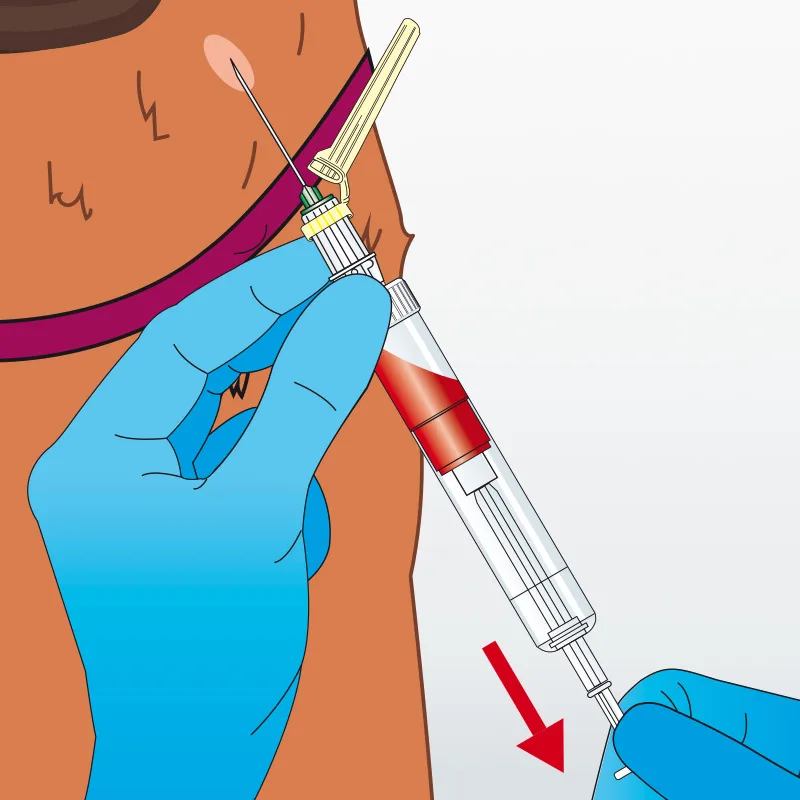 USE - VET - Tierisch schonend Landingpage - S-Monovette® – das geschlossene Blutentnahmesystem - Tierisch schonend