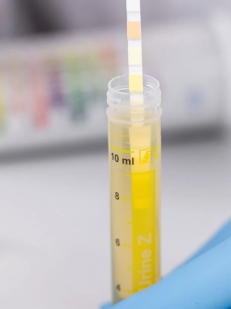 Techniken RS328961-768x1024