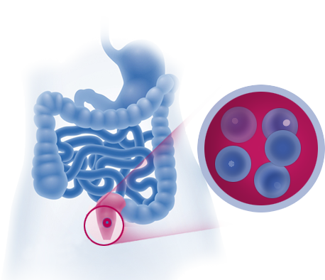 MICROLAX® auttaa pehmentämään ulosteita
