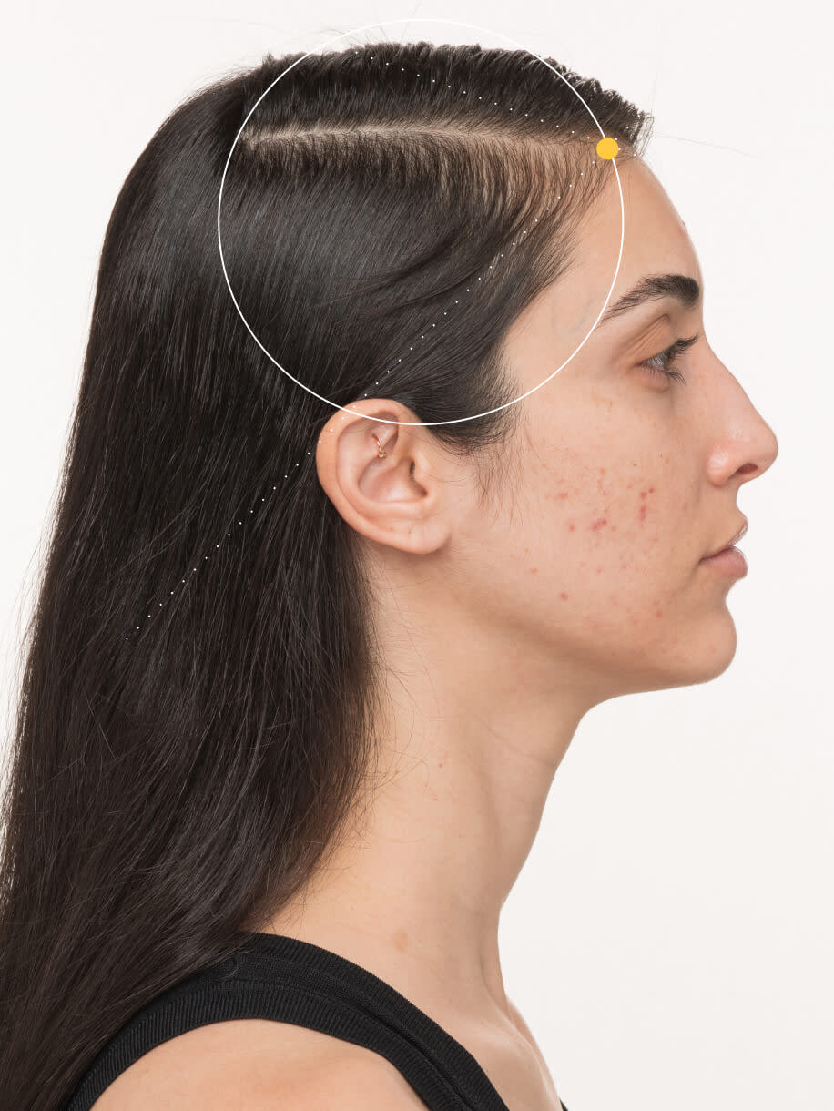 Neghin before taking Nutrafol Postpartum Hair Growth Nutraceutical.