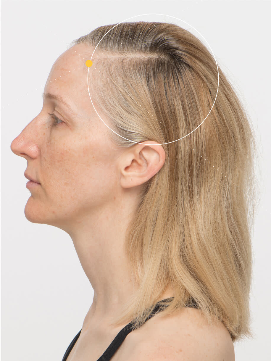 Tanya 3 months into taking Nutrafol Women Hair Growth Nutraceutical. Results are from a clinical study and may vary