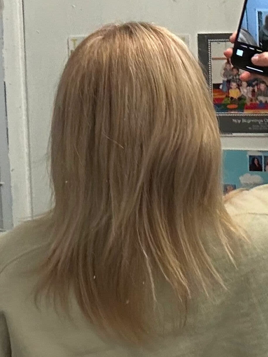 Katie before taking Nutrafol Women Hair Growth Nutraceutical.