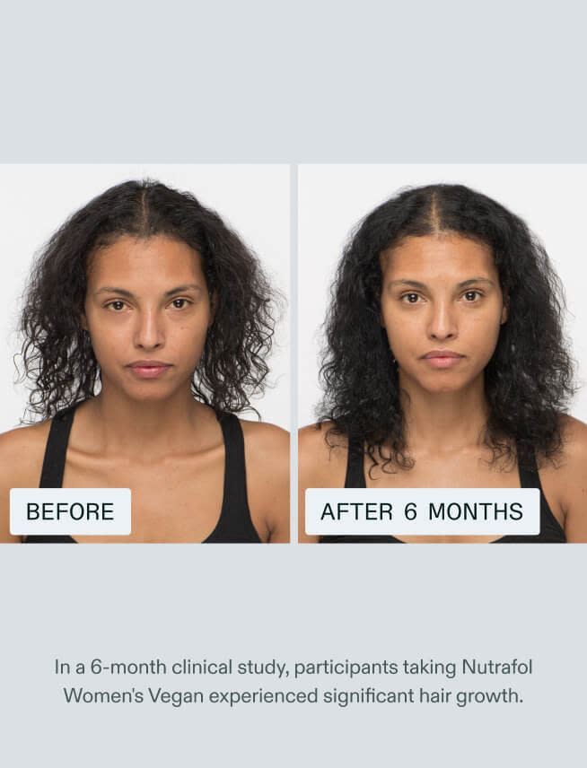 Before and after taking Nutrafol Women. In a 6-month clinical study, participants taking Nutrafol Women experienced significant hair growth.