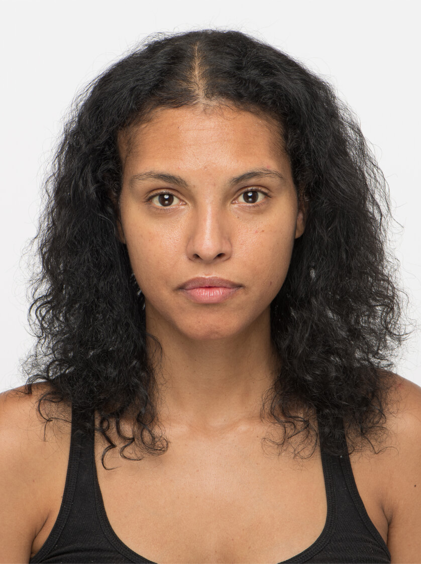 Felisha 6 months into taking Nutrafol Women Vegan Hair Growth Nutraceutical. Results are from a clinical study and may vary