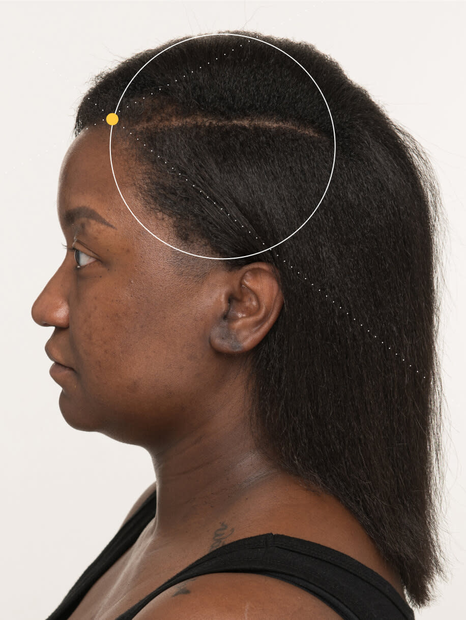 Candace 4 months into taking Nutrafol Postpartum Hair Growth Nutraceutical. Results are from a clinical study and may vary