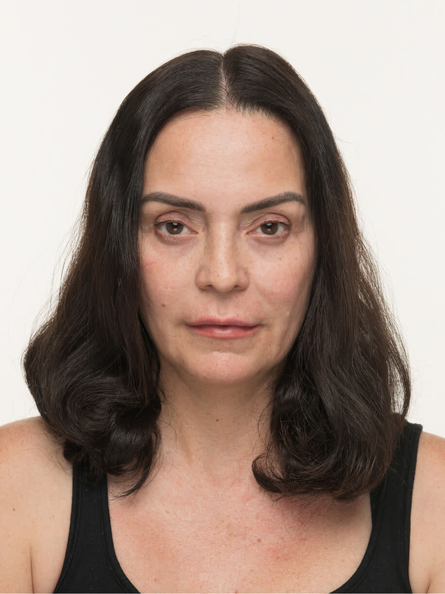 Elsie 6 months into taking Nutrafol Women’s Balance Hair Growth Nutraceutical. Results are from a clinical study and may vary