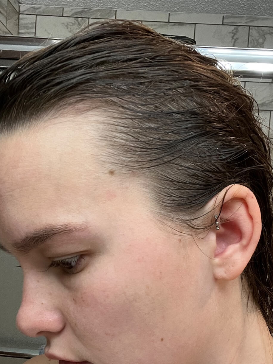 Ashlyn 3.5 months into taking Nutrafol Postpartum Hair Growth Nutraceutical. Results are from a clinical study and may vary