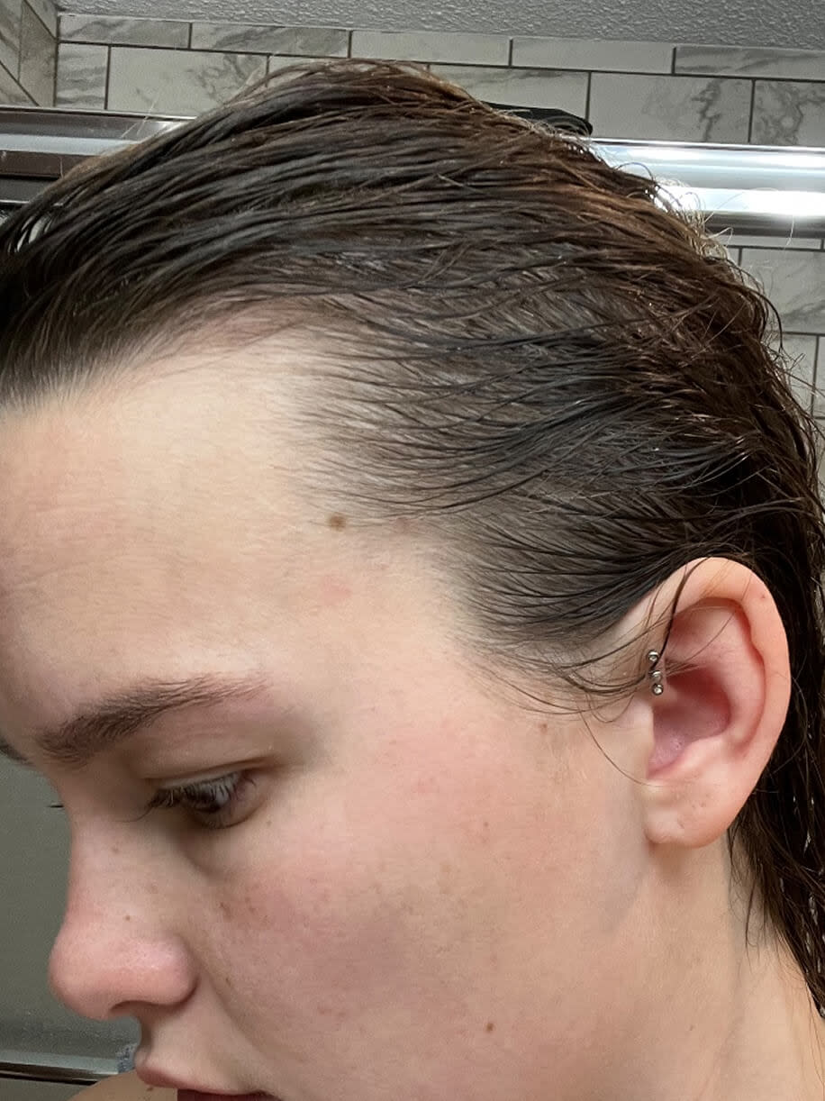 Ashlyn 3.5 months into taking Nutrafol Postpartum Hair Growth Nutraceutical. Results are from a clinical study and may vary