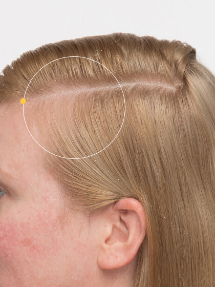 Erryn before taking Nutrafol Women Balance Hair Growth Nutraceutical.