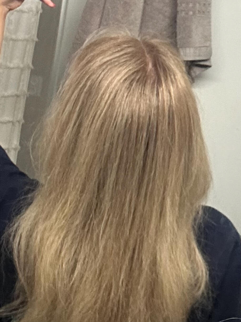 Jamie 4 months into taking Nutrafol Women Hair Growth Nutraceutical. Results are from a clinical study and may vary