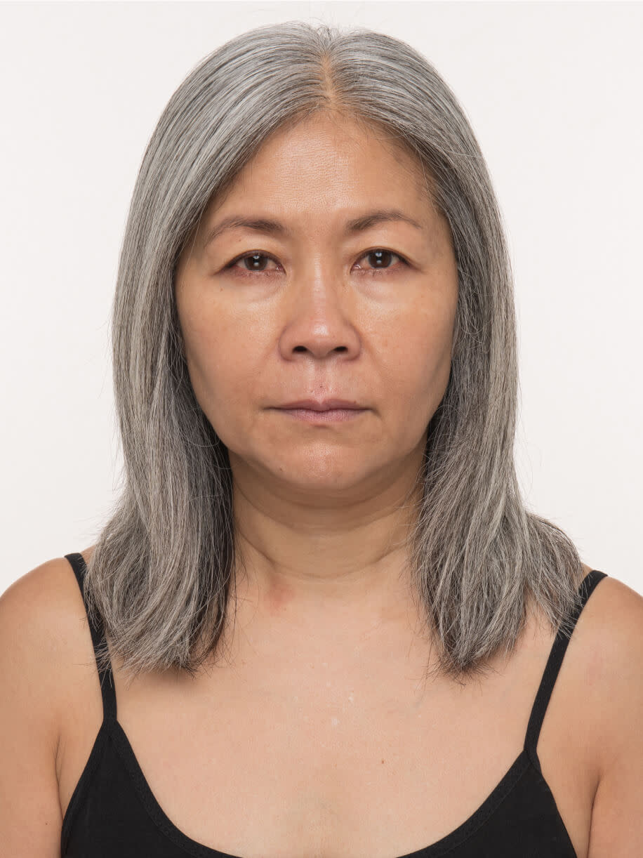 Sherry before taking Nutrafol Women’s Balance Hair Growth Nutraceutical.