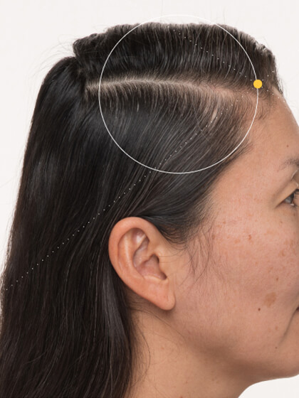 Karin 6 months into taking Nutrafol Women Balance Hair Growth Nutraceutical. Results are from a clinical study and may vary