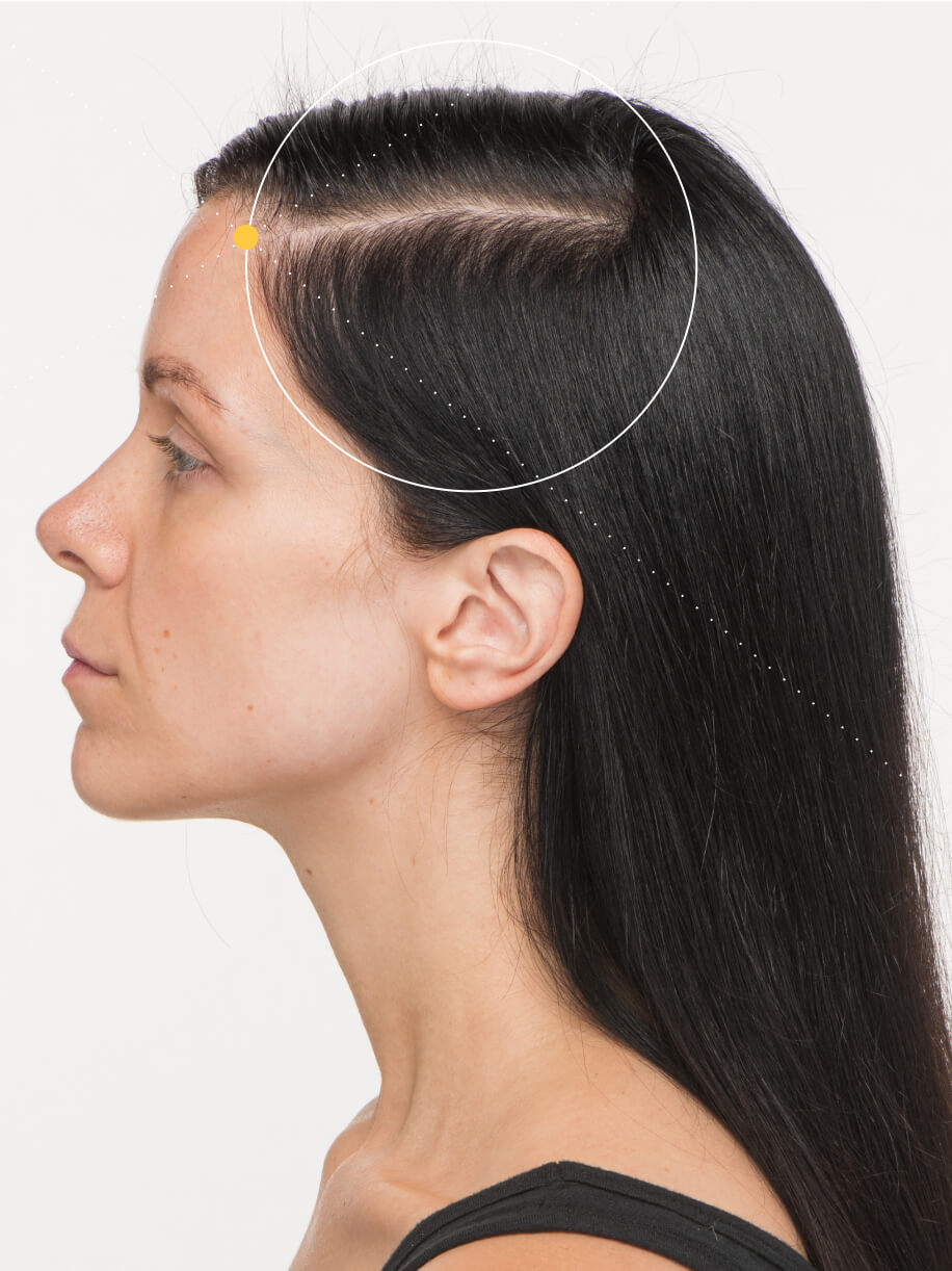 Cat 6 months into taking Nutrafol Women’s Vegan Hair Growth Nutraceutical. Results are from a clinical study and may vary