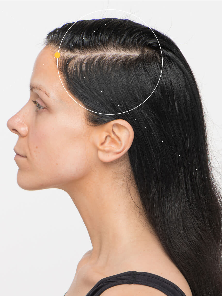Cat before taking Nutrafol Women Hair Growth Nutraceutical.