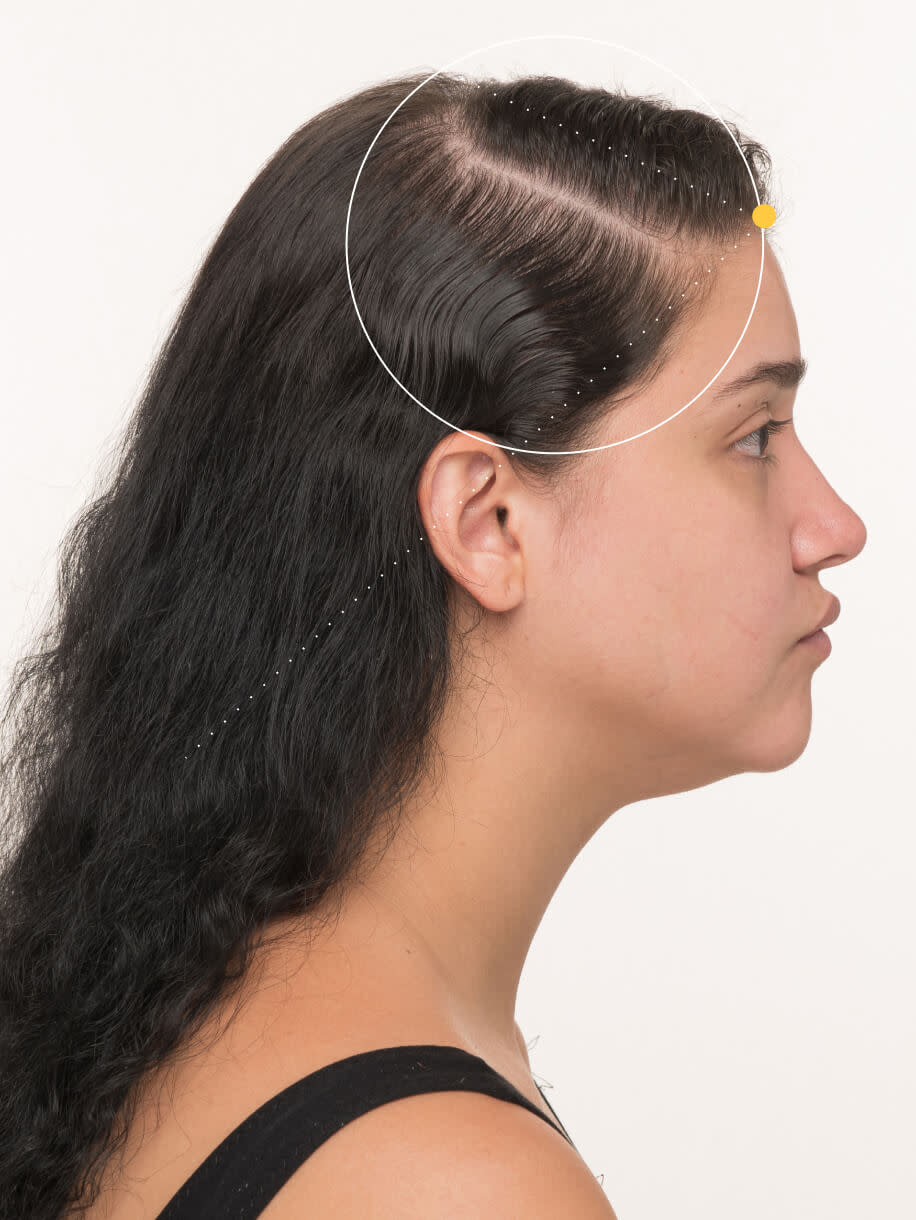 Lilyana 6 months into taking Nutrafol Postpartum Hair Growth Nutraceutical. Results are from a clinical study and may vary