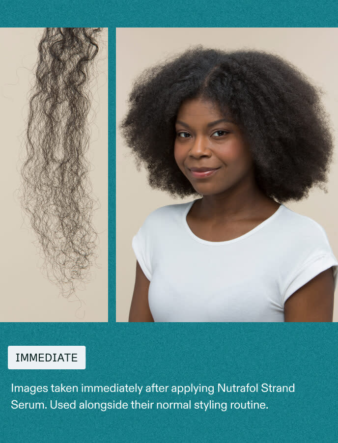 Woman Before using Nutrafol Strand Serum.