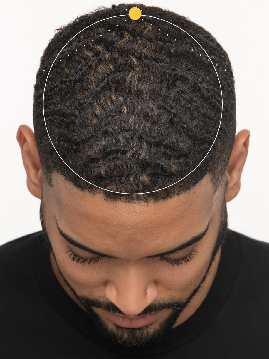 Jason before taking Nutrafol Men Hair Growth Nutraceutical.