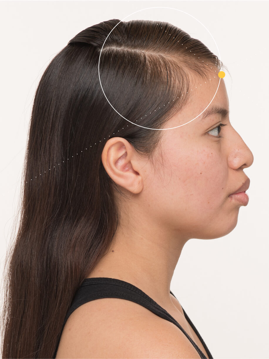 Jessica before taking Nutrafol Postpartum Hair Growth Nutraceutical.