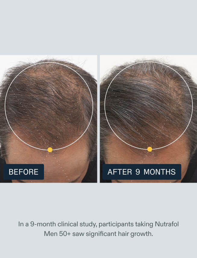 Before and after