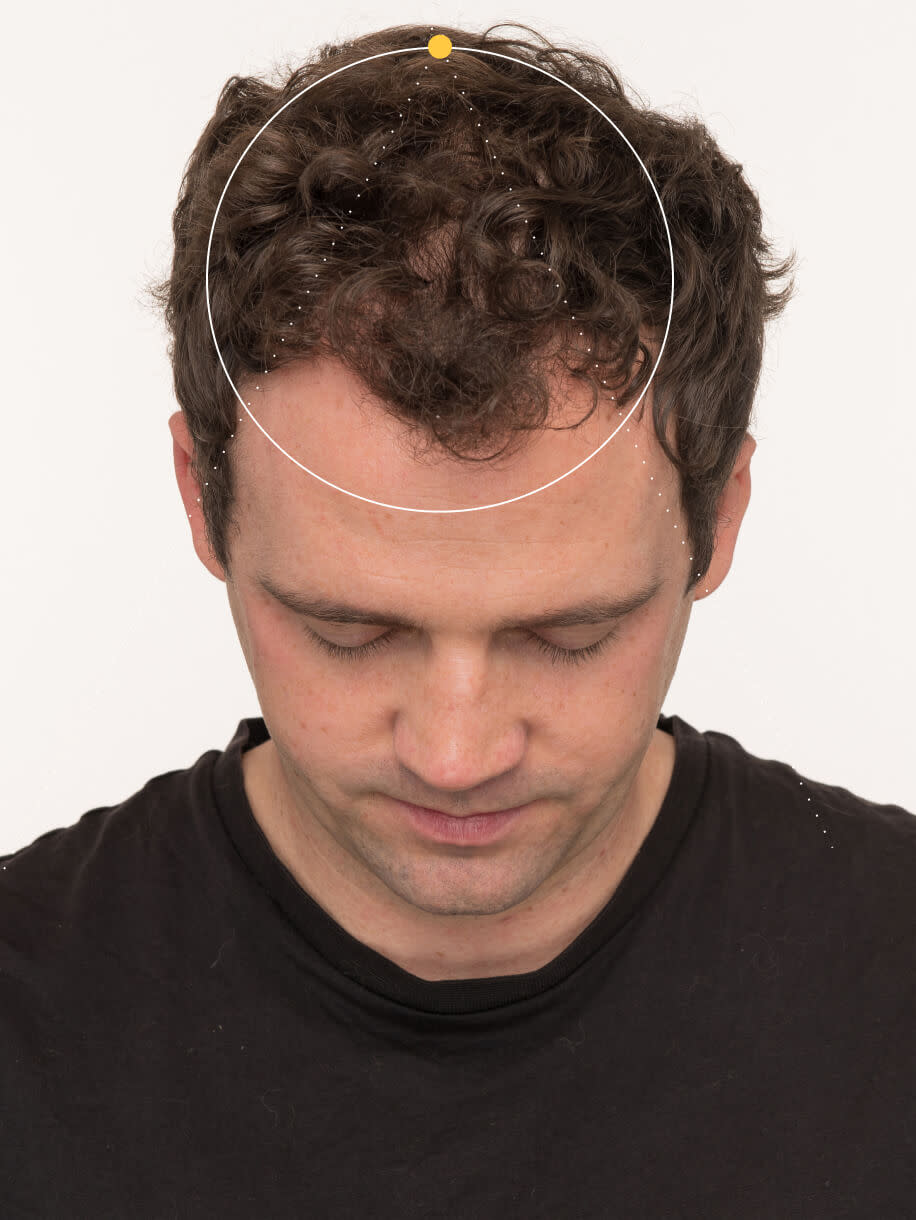 Brian 3 months into taking Nutrafol Men Hair Growth Nutraceutical. Results are from a clinical study and may vary