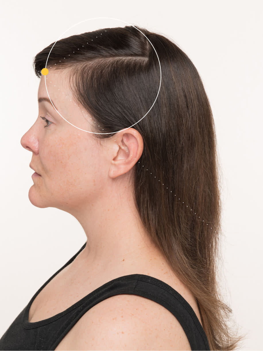 Lindsey 3 months into taking Nutrafol Women Hair Growth Nutraceutical. Results are from a clinical study and may vary