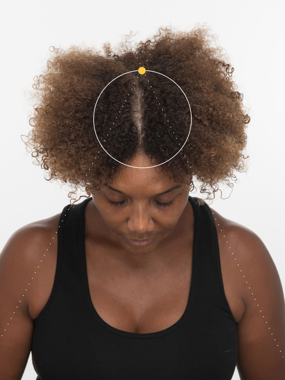 Kimberly before taking Nutrafol Women’s Balance Hair Growth Nutraceutical.