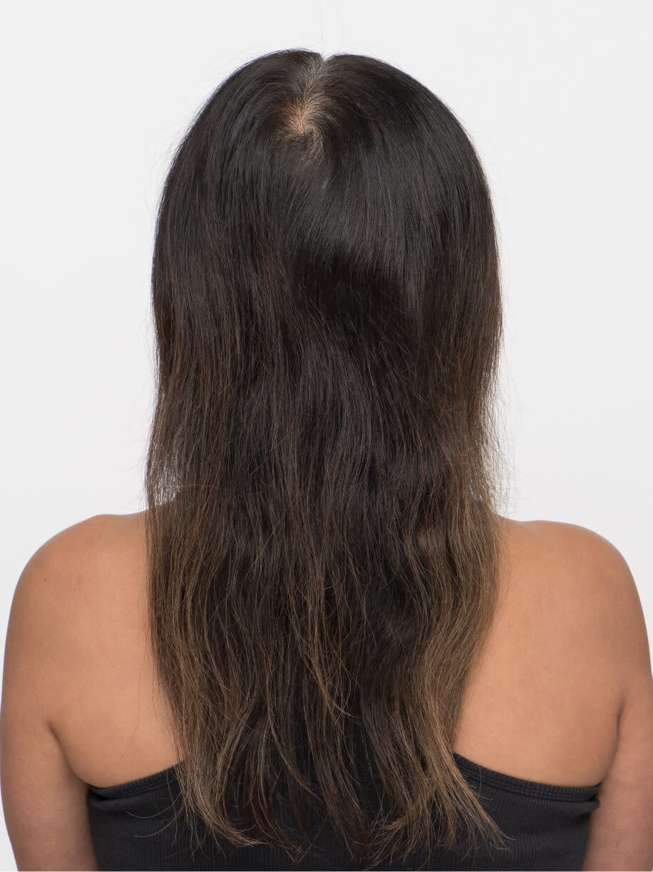 Francine before taking Nutrafol Women Hair Growth Nutraceutical.