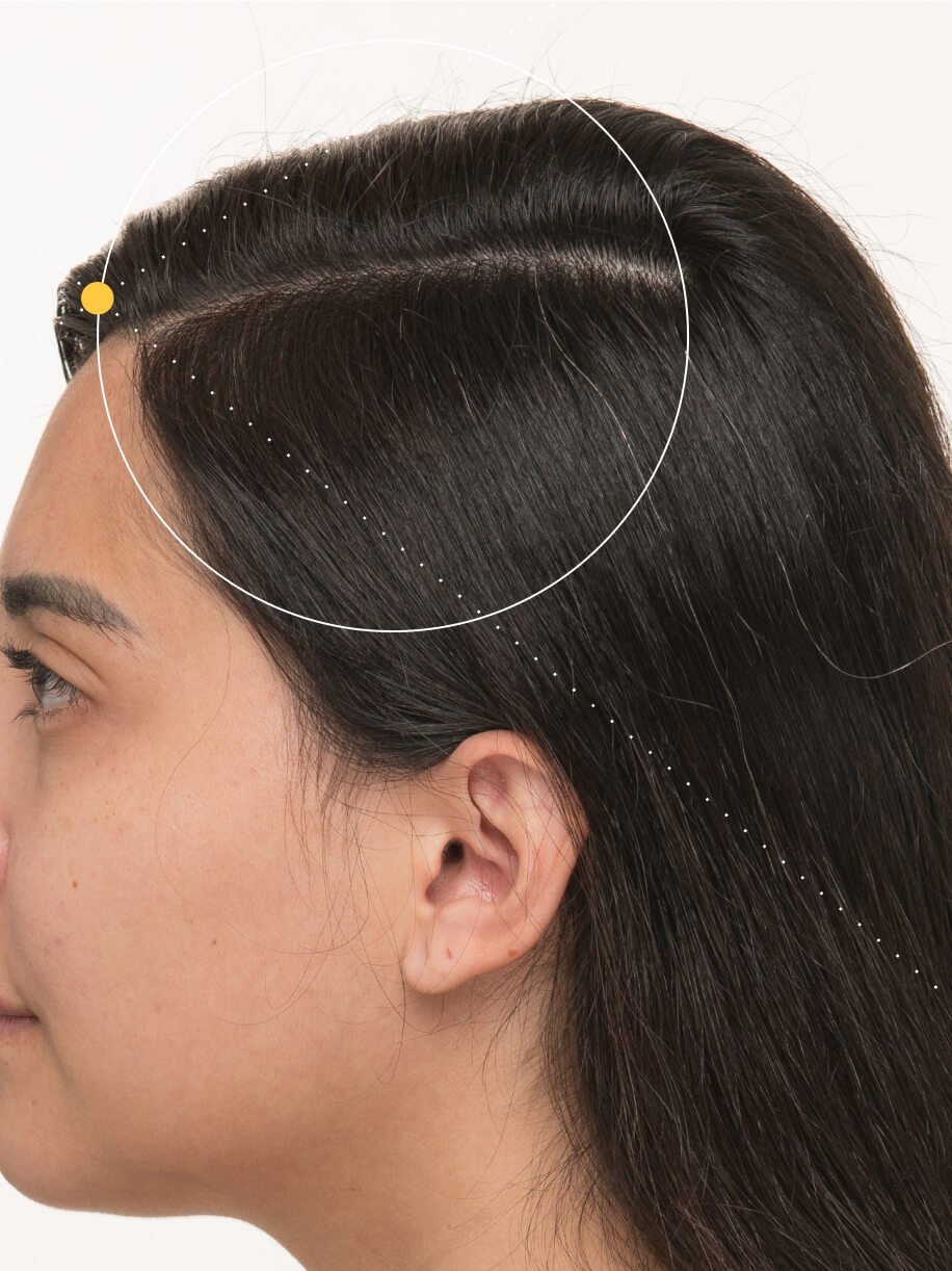 Karen 6 months into taking Nutrafol Postpartum Hair Growth Nutraceutical. Results are from a clinical study and may vary