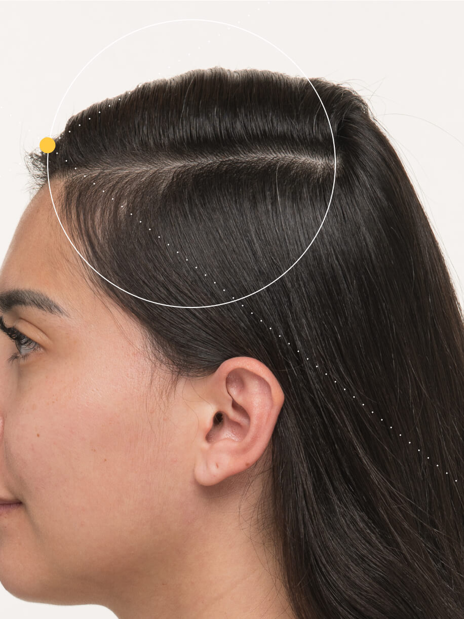 Karen before taking Nutrafol Postpartum Hair Growth Nutraceutical.