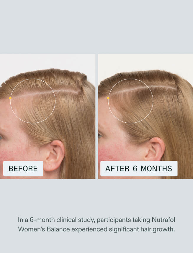 Before and after