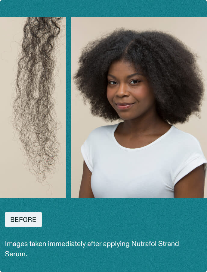 Woman Before using Nutrafol Strand Serum.