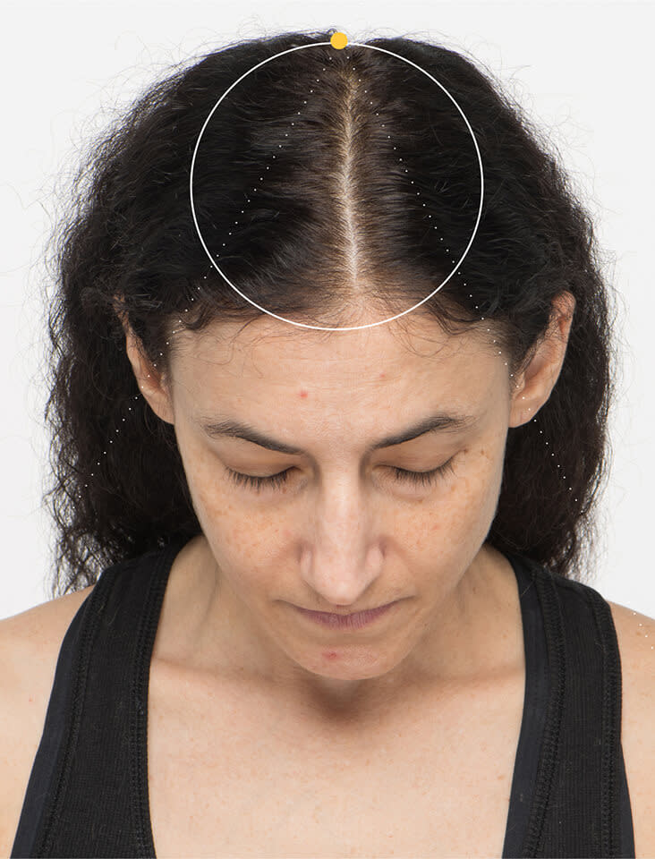 Aliza before taking Nutrafol Women Hair Growth Nutraceutical.