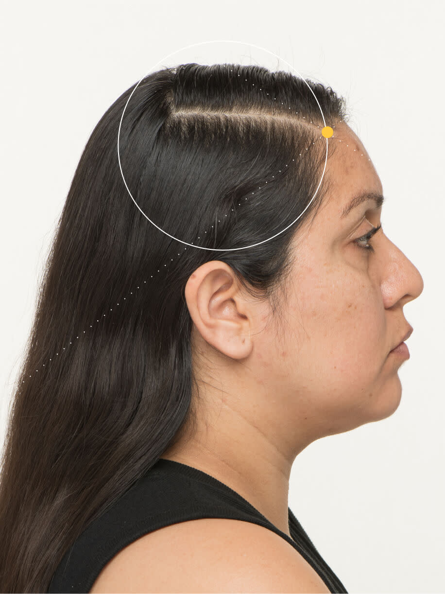 Kristy 6 months into taking Nutrafol Women Hair Growth Nutraceutical. Results are from a clinical study and may vary