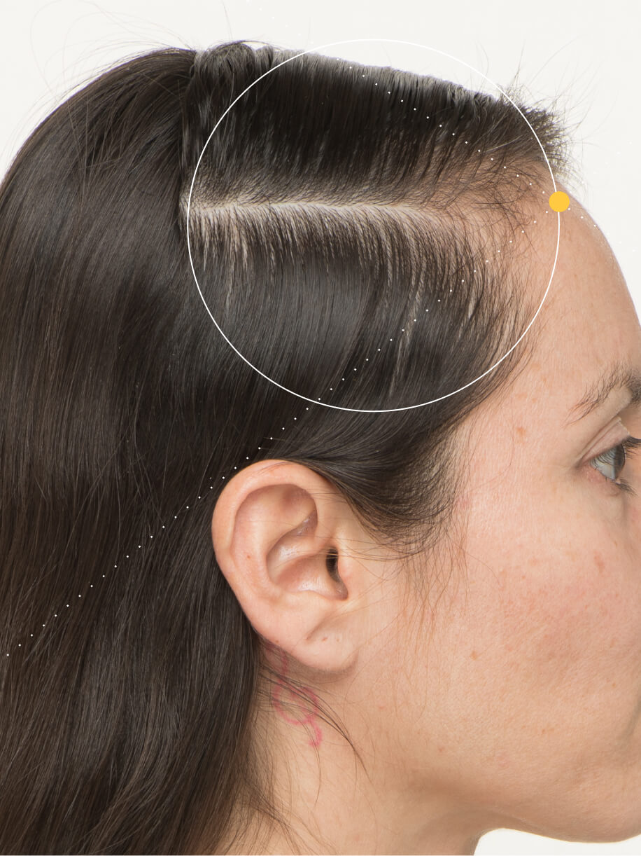 Alejandra 6 months into taking Nutrafol Women Hair Growth Nutraceutical. Results are from a clinical study and may vary