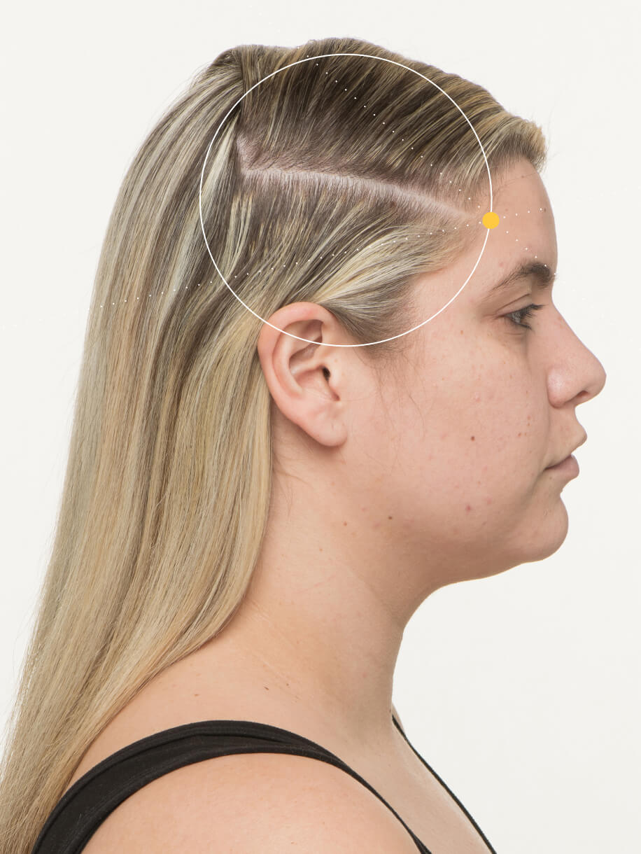 Ensley 6 months into taking Nutrafol Women Hair Growth Nutraceutical. Results are from a clinical study and may vary