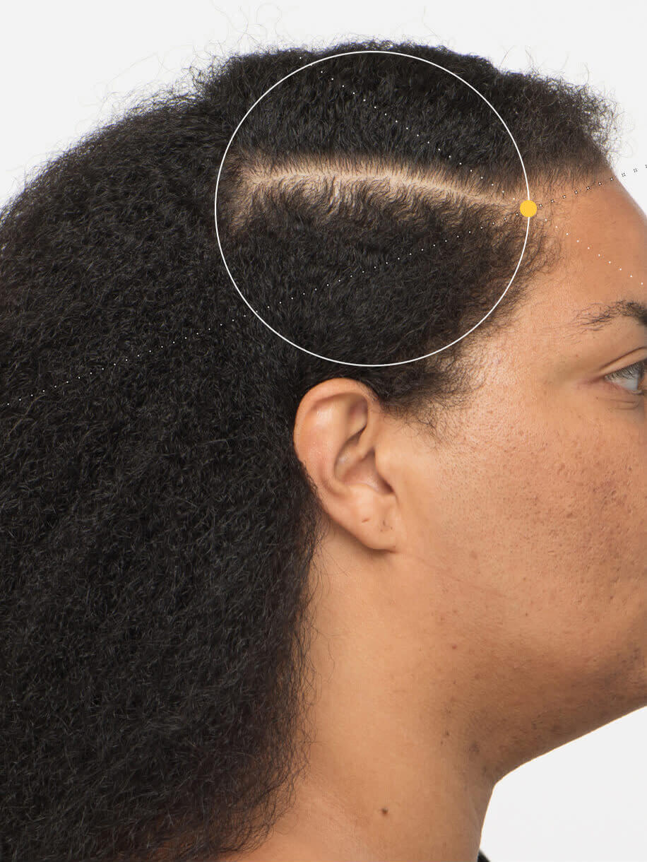 Dawnte before taking Nutrafol Women Hair Growth Nutraceutical.