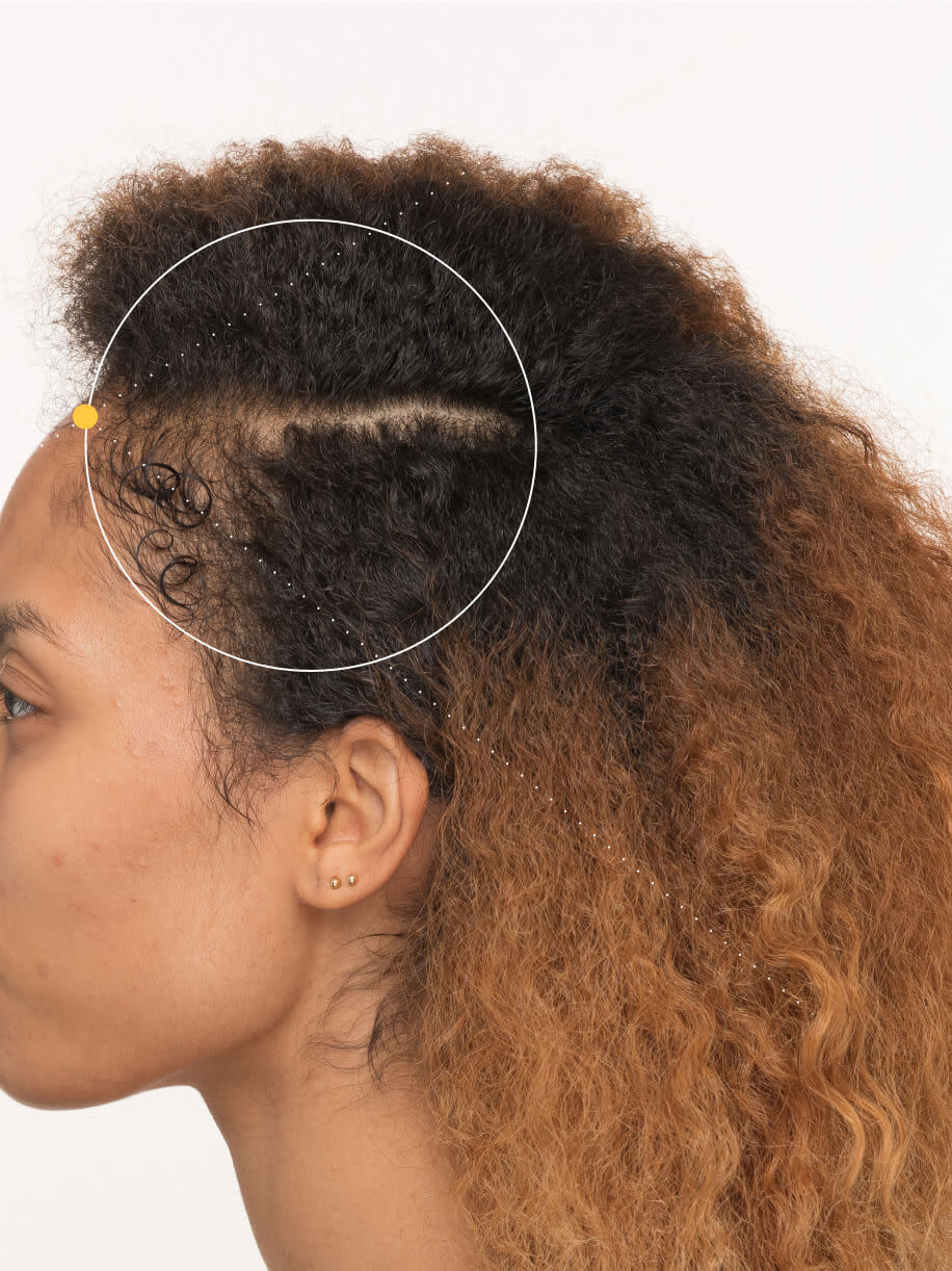De’yanna before taking Nutrafol Postpartum Hair Growth Nutraceutical.