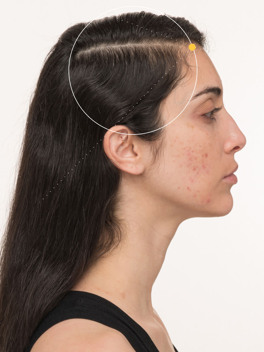 Neghin 6 months into taking Nutrafol Postpartum Hair Growth Nutraceutical. Results are from a clinical study and may vary