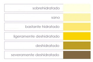 Qué significa el color de la orina
