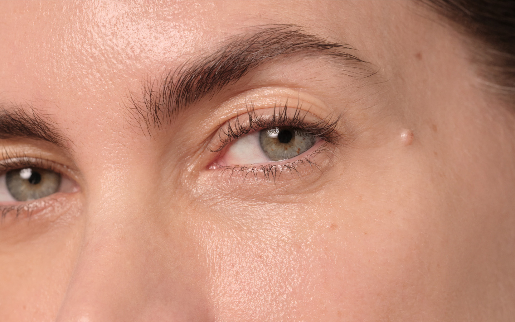 Eczéma des paupières causes et traitements AromaZone — free download