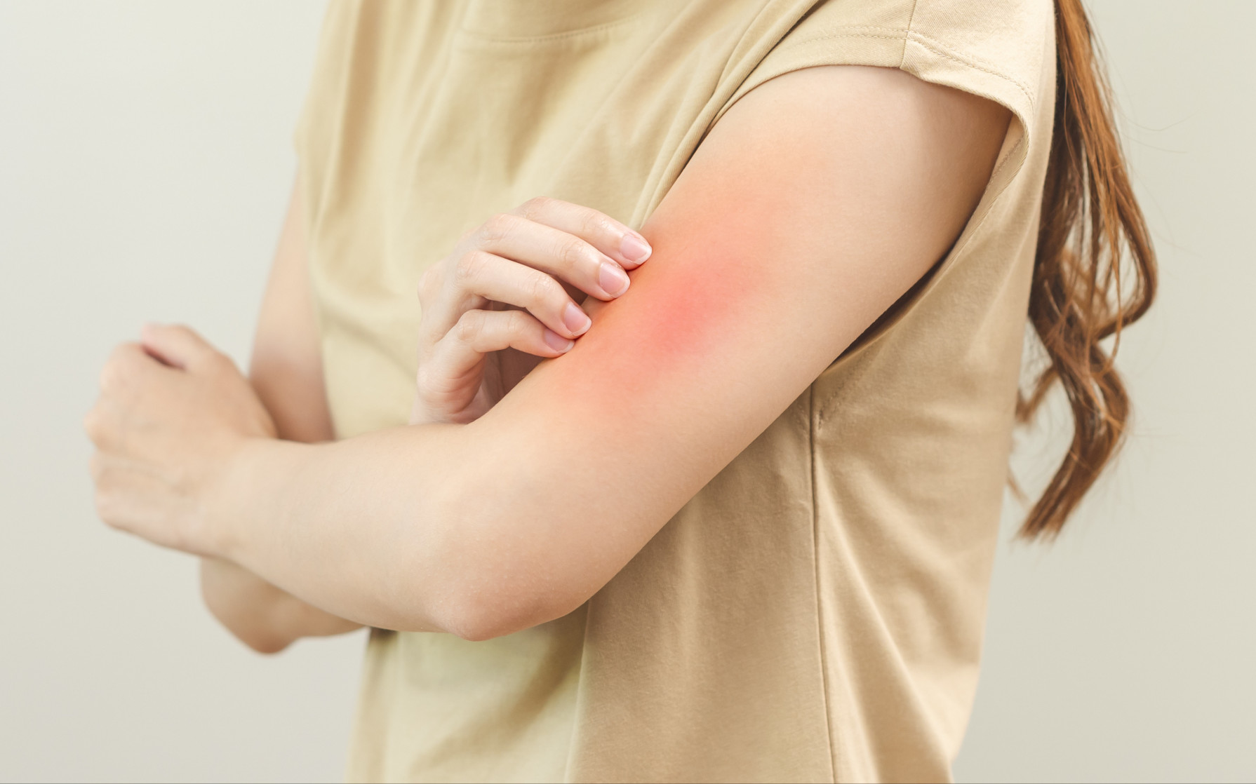 Piqûre de moucheron, que faire ? - Aroma-Zone