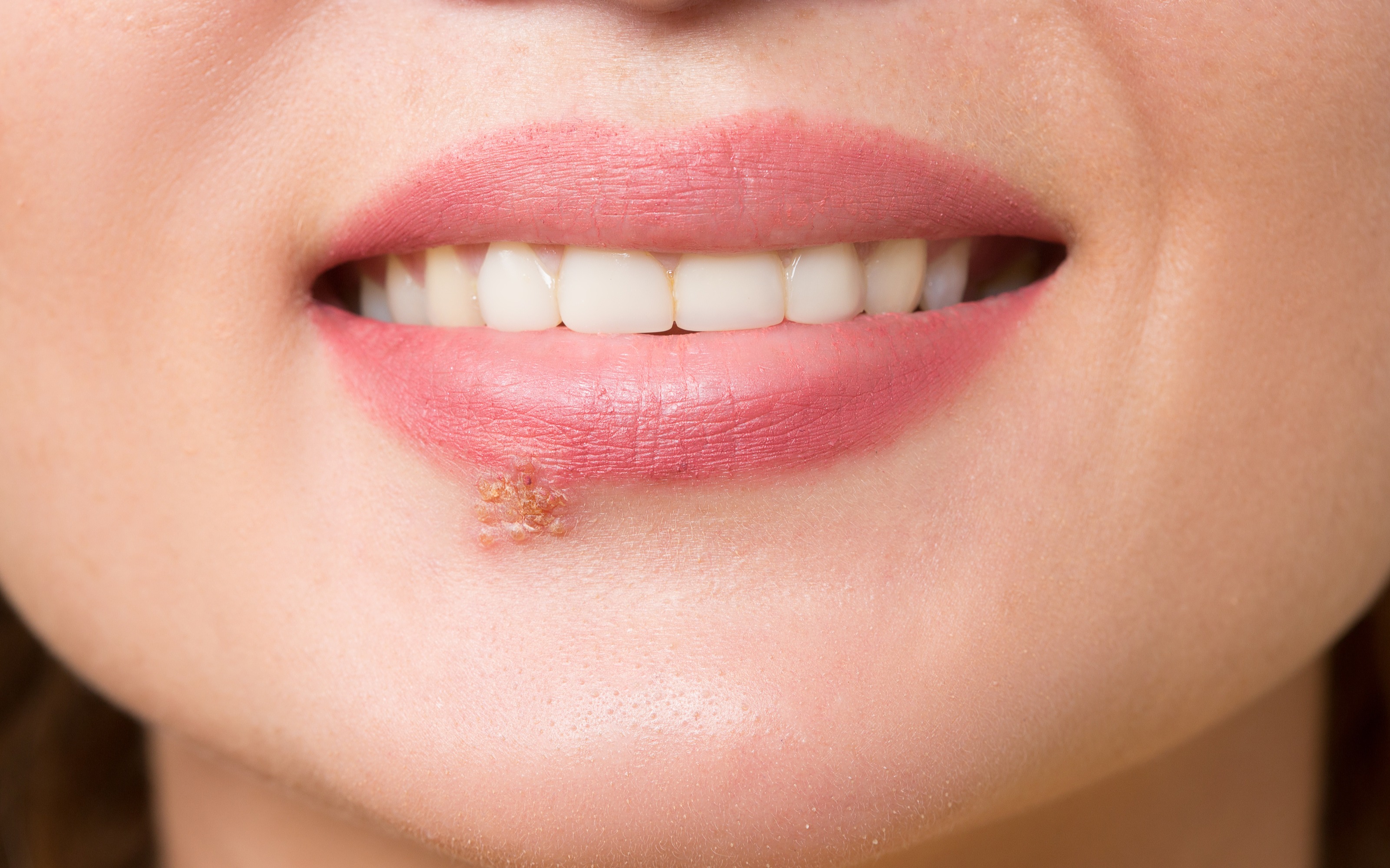 Vet Focus La dermatite atopique féline démystifiée | Royal Canin Academy, image size:3200x1998