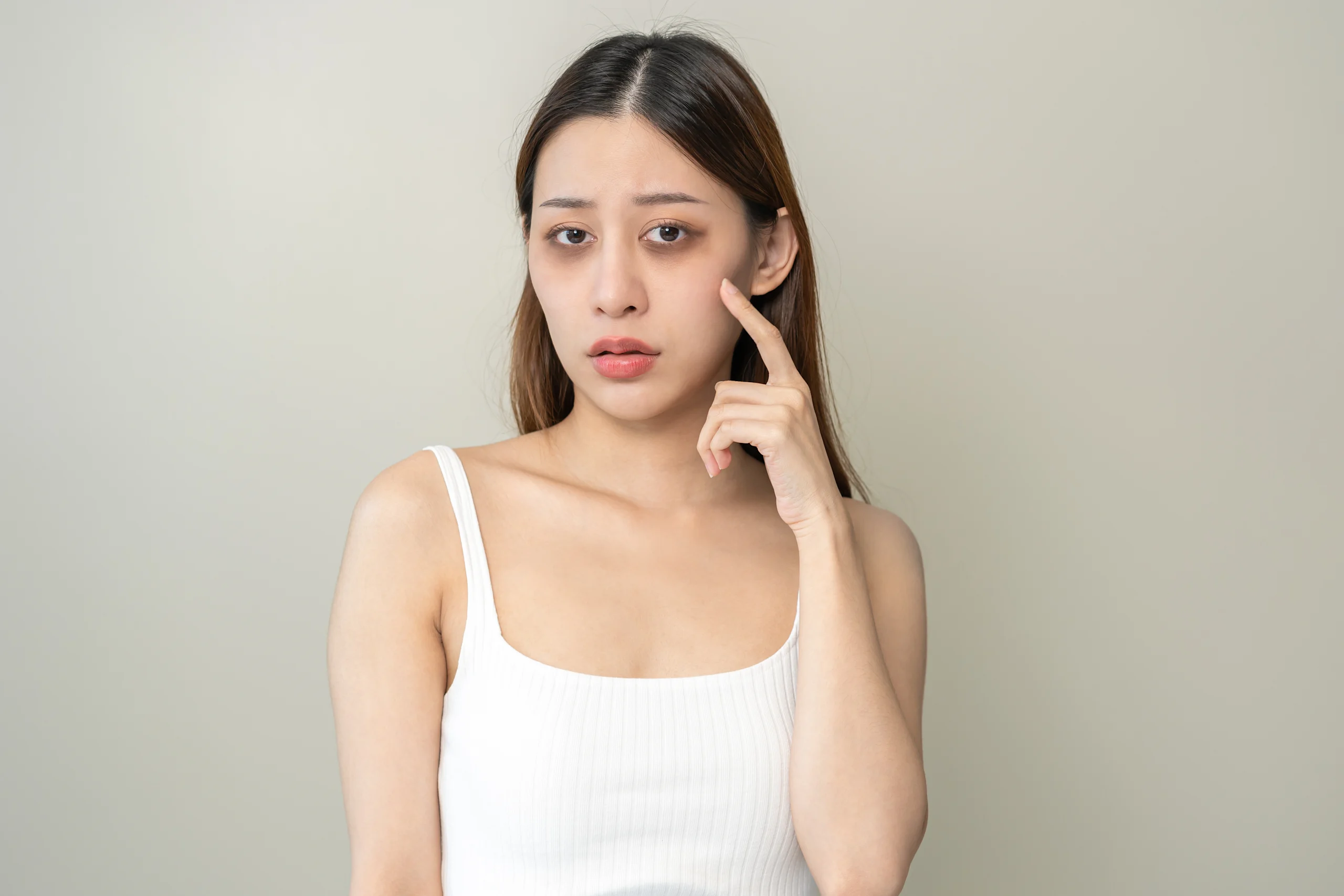 Nainen osoittaa tummia silmänalusiaan